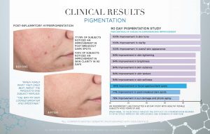 pigmentation-clinical-study-results